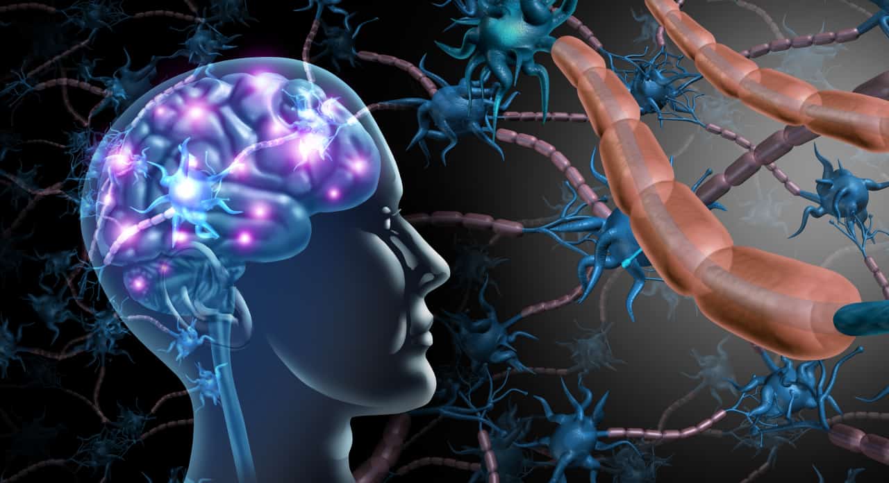 Cellule nervose cerebrali coinvolte nel processo che porta alla patologia della sclerosi multipla